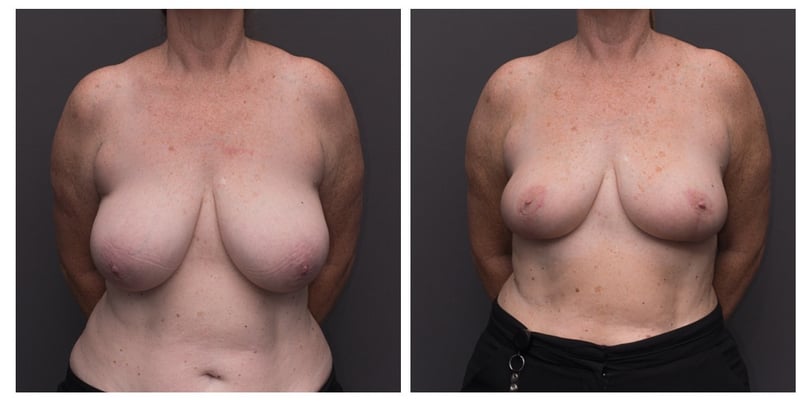 6057_Avery_B4&Afters_2020-April-August-Social-Update_V1-062