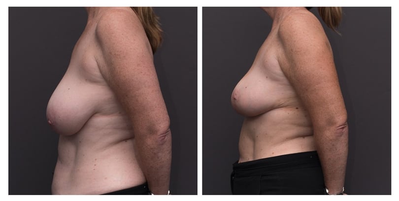 6057_Avery_B4&Afters_2020-April-August-Social-Update_V1-064
