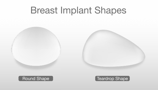 Breast-Implant-Shapes