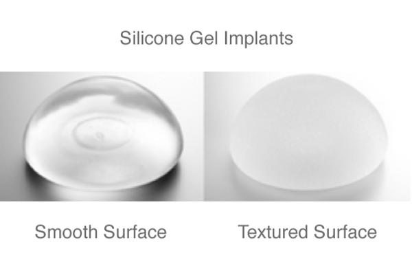 Silicone-Gel-Breast-Implants